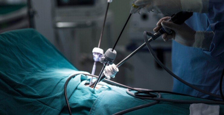 MINIMALLY INVASIVE SURGERY